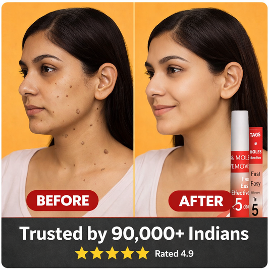 NatureSkin Tag & Mole Remover